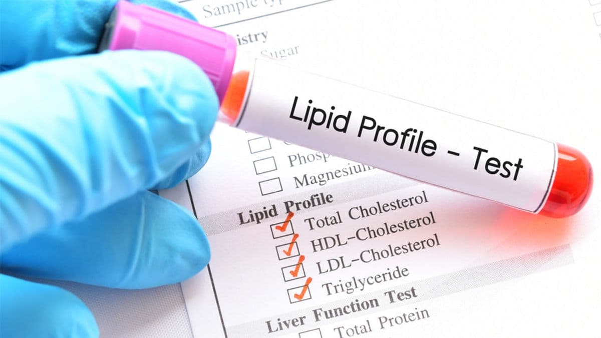 How to Understand Your Lipid Profile