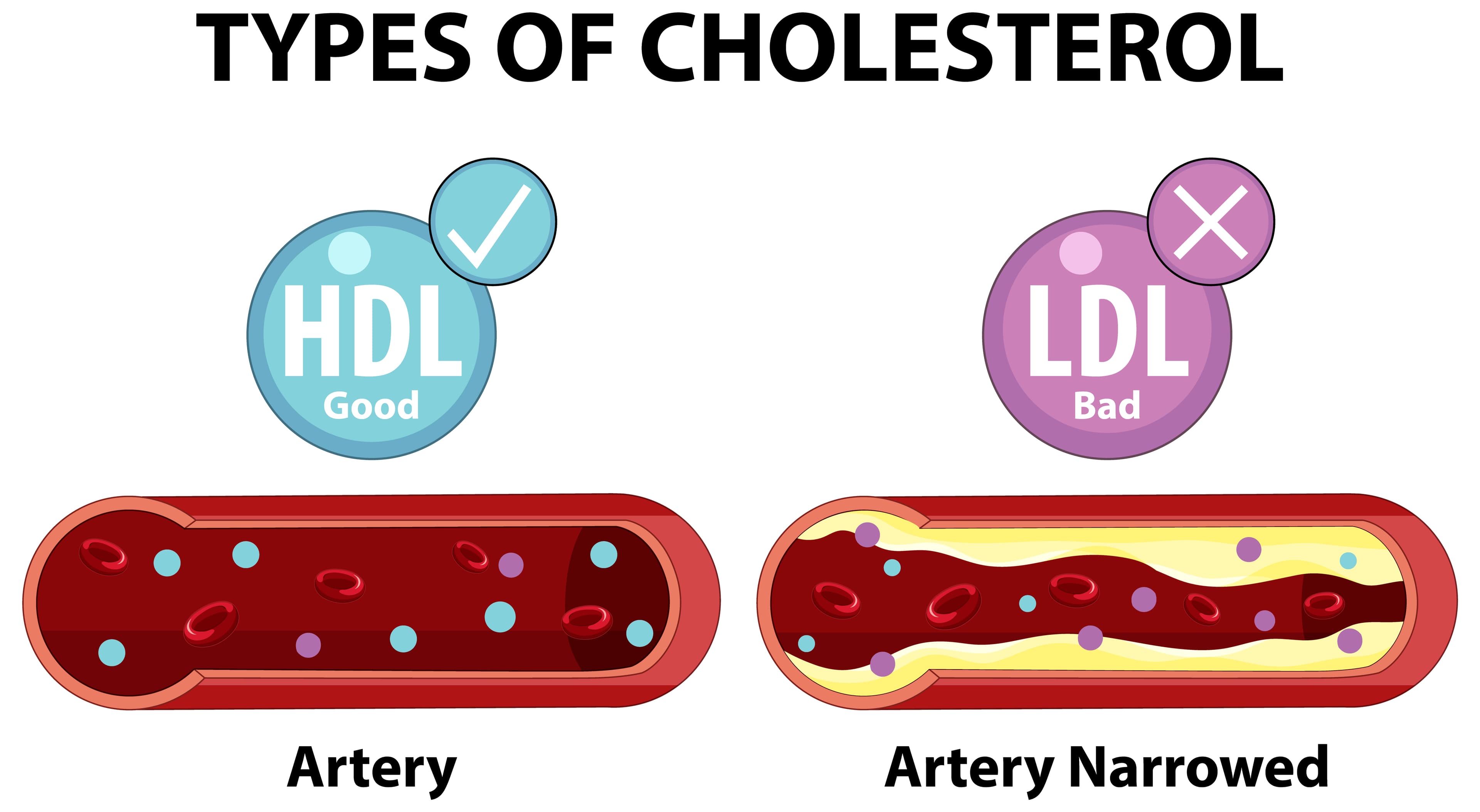 Triglycerides Explained: What High Levels Mean for Your Heart Health